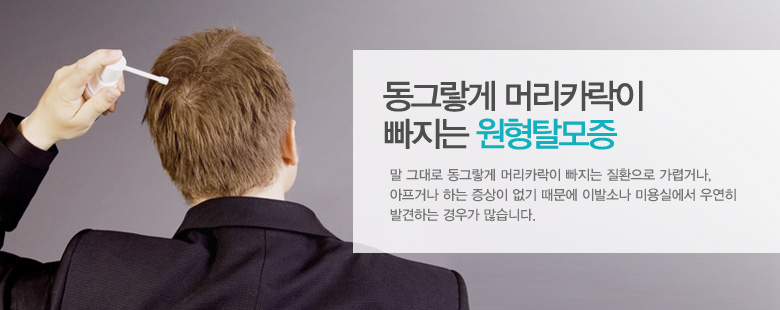 동그랗게 머리카락이 빠지는 원형탈모증